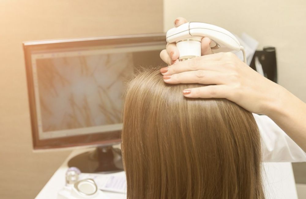 HAIR LOSS TREATMENT BARCELONA