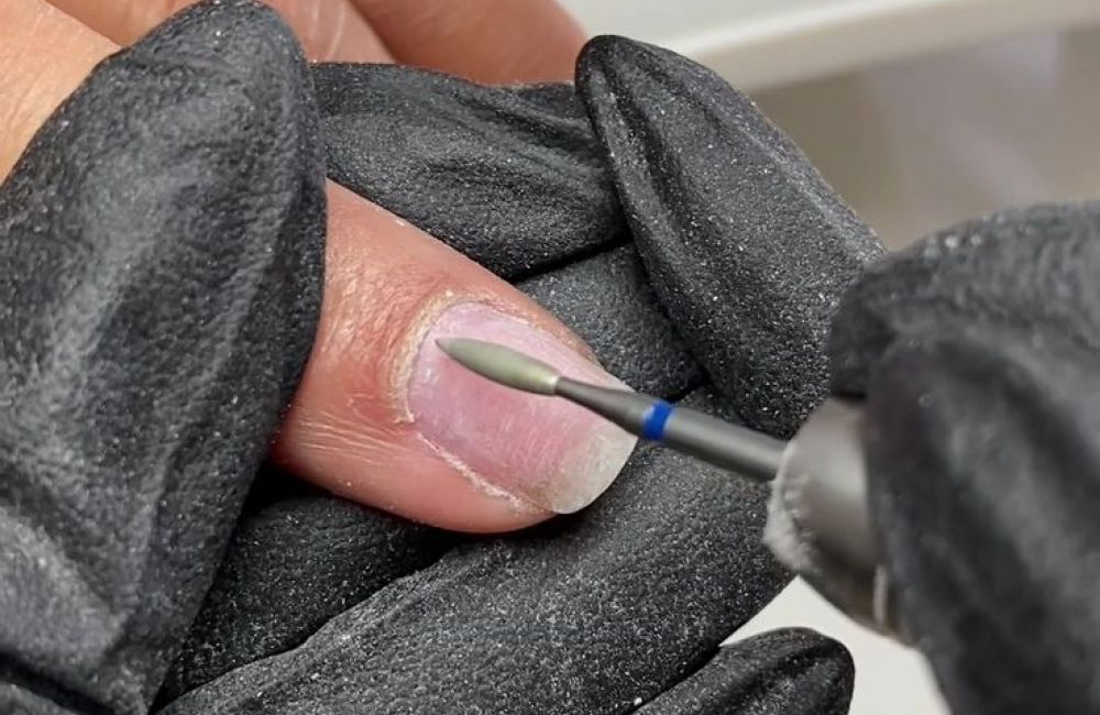 Treure semipermanent