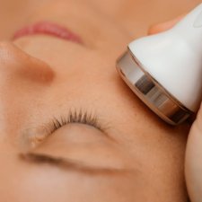 Facial radiofrequency